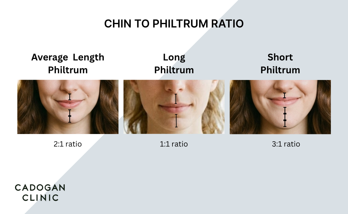 An infographic showing different chin to philtrum ratio measurements